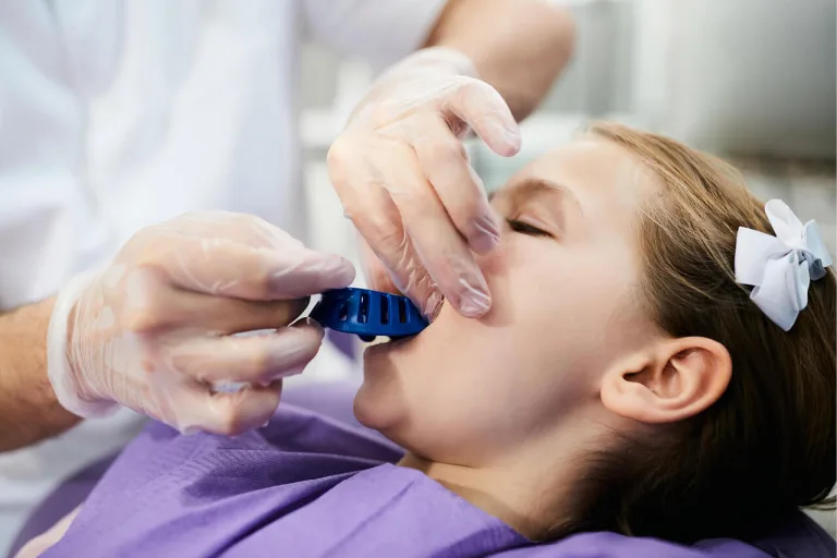 Taking dental impressions from children: aspects to consider and recommended procedures and alginates