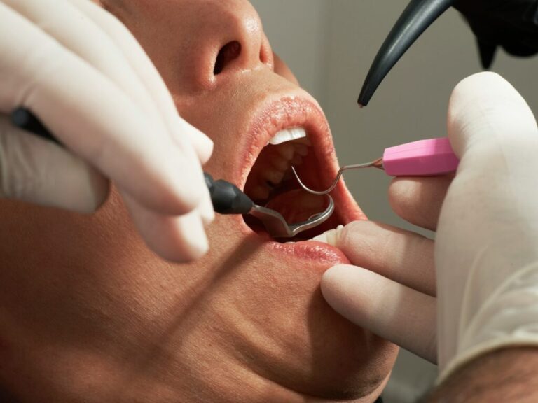 6 Tips to Make Your First Dentist Visit After a While Easy